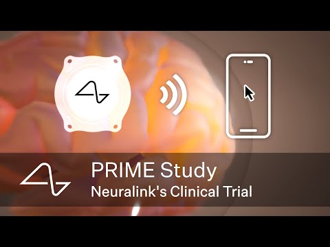 Neuralink’s Clinical Trial: The PRIME Study